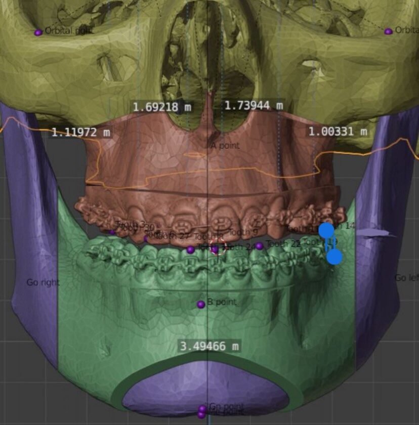 Instagram post from cbm.brasilia. This post is in position 1.