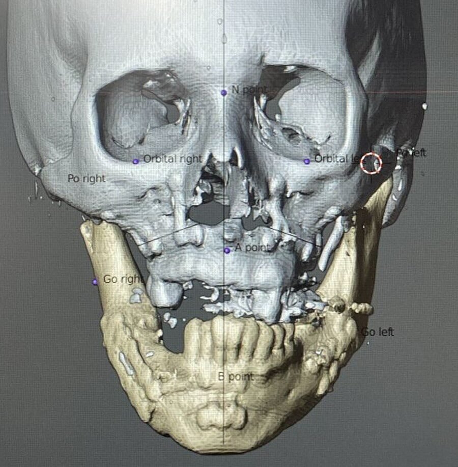 Instagram post from cbm.brasilia. This post is in position 2.