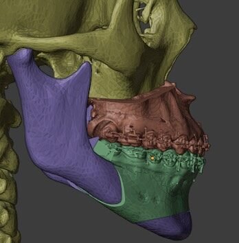 Instagram post from cbm.brasilia. This post is in position 3.