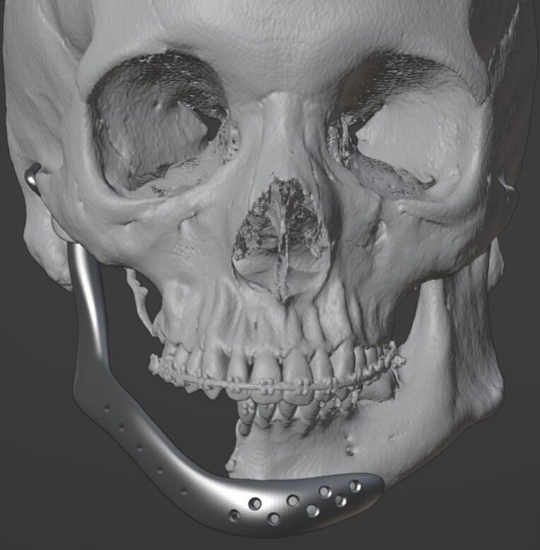 Instagram post from cbm.brasilia. This post is in position 7.